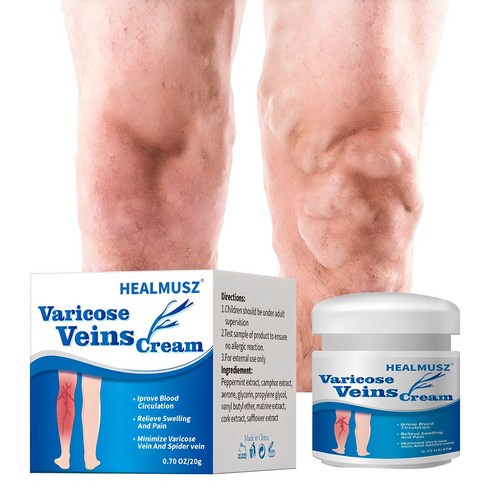 healmusz 하지정맥류 크림 - HEALMUSZ 하지정맥류 하지정맥 하지정맥류 다리부종 붓기 정맥류 연고 하지정맥크림, 1개