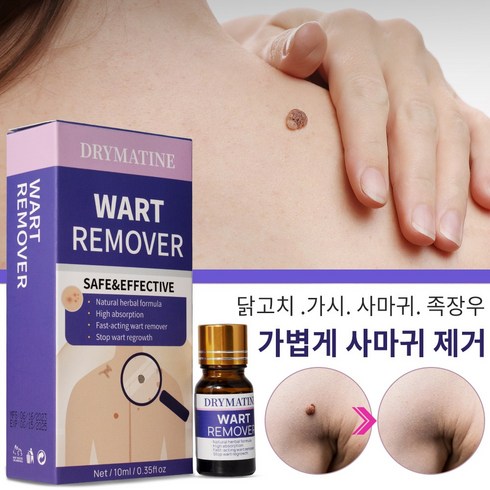 티눈제거약 - DRYMATINE 사마귀 피부 라벨 바디케어 발손케어 에센스, 1개, 10ml