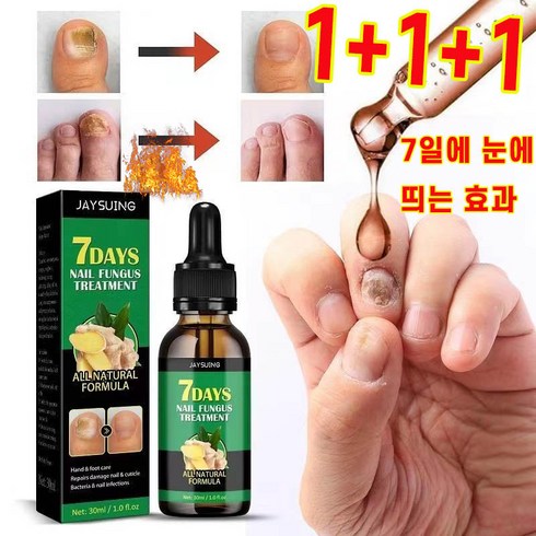 1+1+1 톱무좀 영양제 셀라큐어 문제성톱 네일 솔루션 리페어 앰플 에센스 톱강화, 1+1+1(3개)