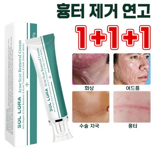 [1+1특가] 흉터 제거 연고 재생 크림 화상 수술 상처 치료 재생연고 사은품증성, 30ml, 3개