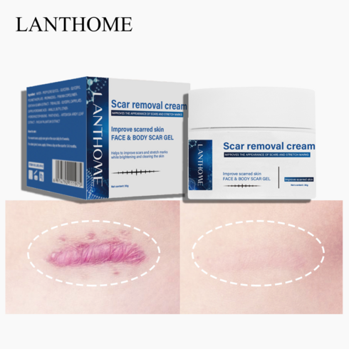 LANTHOME 흉터제거연고 화상 상처 흉터흔적지우개 크림, 30g 2개, 2개