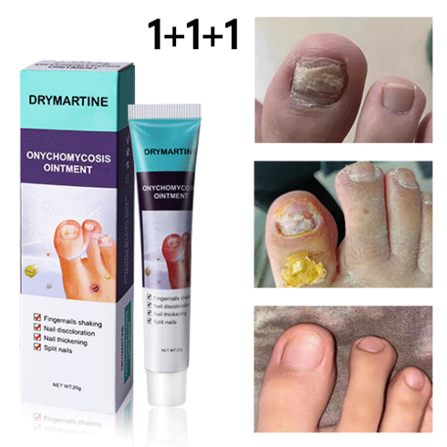 DRYMARTINE 무좀 연고 발톱무좀 발 관리 연고, 3개, 20ml