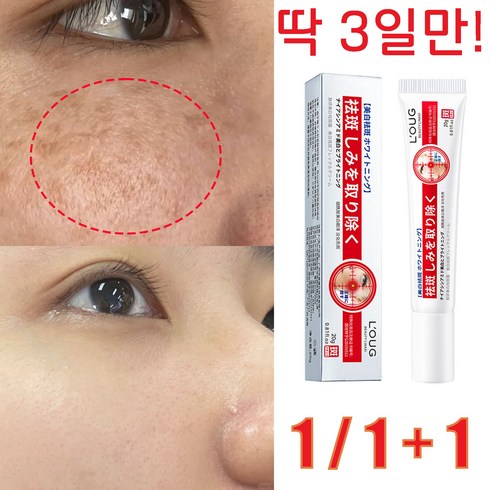 일본 1/1+1 주근깨 제거 크림 기미 잡티 검버섯 제거 미백 크림 피부 개선 20g, 1+1+1(3개)
