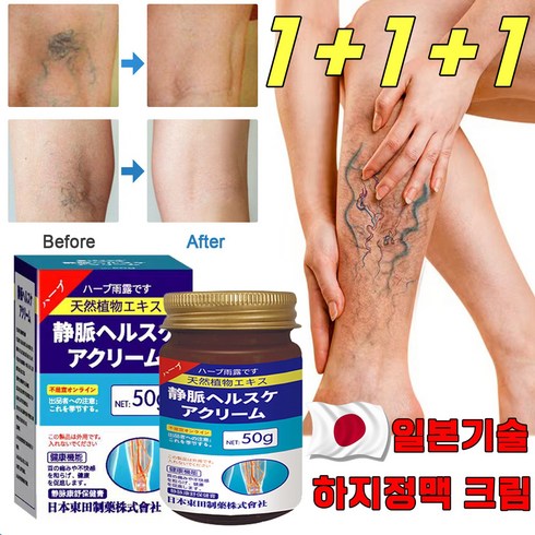 healmusz 하지정맥류 크림 - [일본 기술] 하지정맥 크림 하지정맥류 연고 다리부종 정맥염 혈관염 치료 크림, 3개, 50g