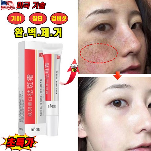 멜라논크림 - [3일만 효과보장] 1/1+1/2+2 멜라토닝 들깨기미크림 멜라논크림 기미 잡티 검버섯 주근깨 제거 크림 미백 착색크림, 1개, 20g