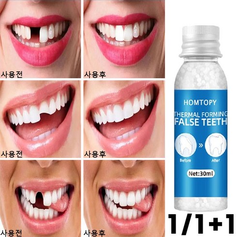 1+1/1 셀프 접착제 세트 임시 수리 고체 젤 키트 30ml, 1+1(2개) 추천