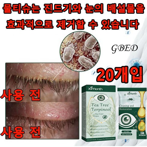 마이봄샘관리세트 - GBED 안구건조증 눈기름샘청소 진드기퇴치 눈꺼풀세정제 단백질제거제 노폐물제거눈물 눈기름샘청소 아이케어, 1세트, 수량