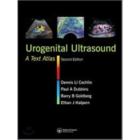ultrasound TOP01
