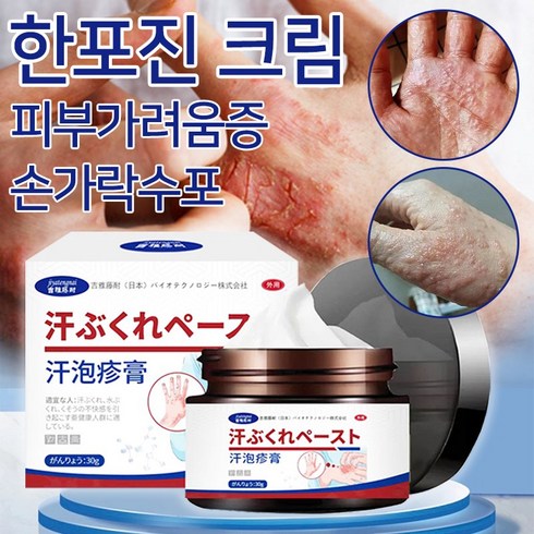 한포진연고 - [일본 수입] 한포진 크림 빠르고 효과적인 치료 두드러기 피부발진 손가락수포 피부가려움 피부곰팡이균 각종 피부병 ZJ003, 2개, 30g