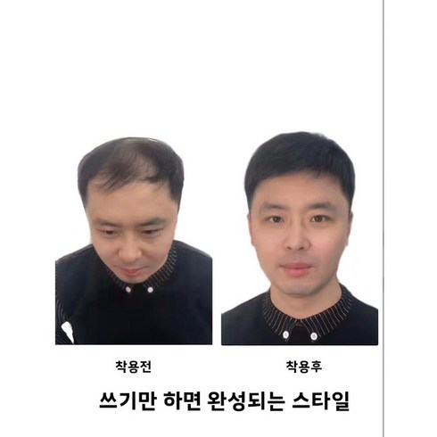 남자부분가발 - 남자 정수리 부분가발 남자가발 인모가발 남자단발가발 자연가발 패션가발, 내추럴형 16*18cm, 1개