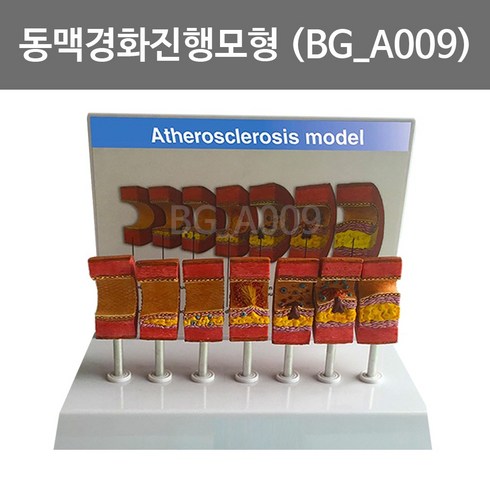 보건몰 동맥경화진행모형 (BG-A009)