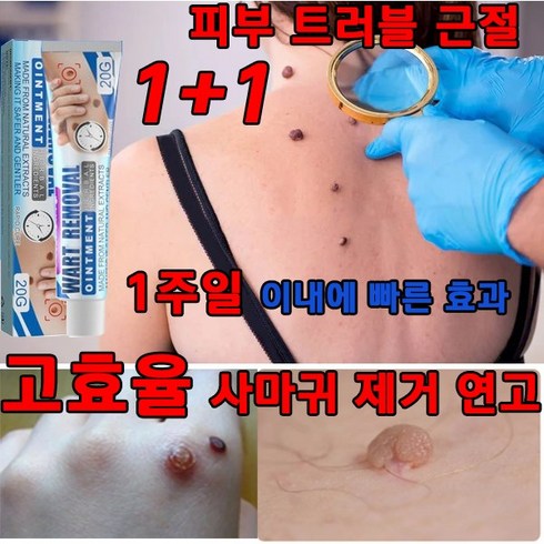 [한국셀러] jaysuing1+1 미국 약 제거약 천연성분 손가락 치료 피부치료, 1개, 20g