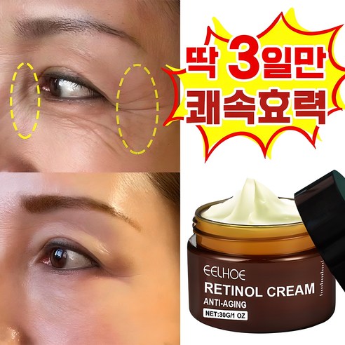 [빠른배송] 주름 개선 재생 레티놀 크림 모공수축 팔자 목 눈밑 주름 크림 탄력 영양 미간 눈가 수분크림, 2개, 50g