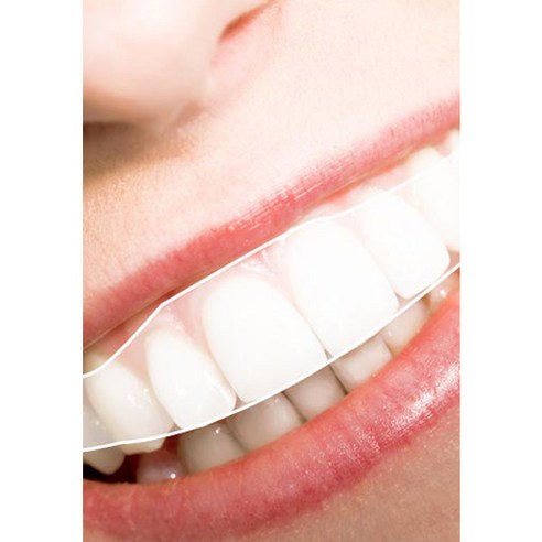 뉴 메디슨화이트 치아 미백패치는 치아 미백을 위한 셀프 화이트닝 제품입니다.