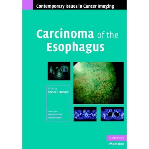 Carcinoma of the Esophagus Hardcover, Cambridge University Press