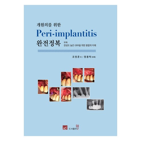 개원의를 위한 Peri-implantitis 완전정복, 웰, 조영준