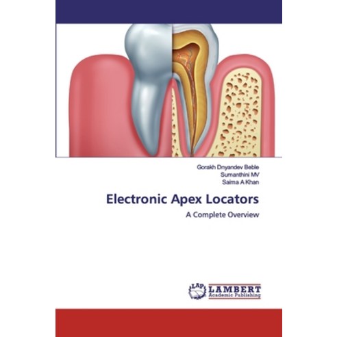 Electronic Apex Locators Paperback, LAP Lambert Academic Publishing