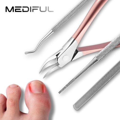 더 이상 숨기지 마세요! 파고드는 발톱, 집에서 쉽고 깔끔하게 관리하는 방법 내성발톱치료