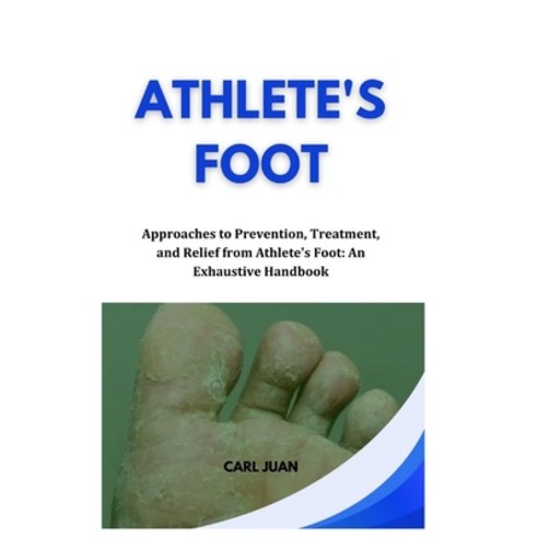 (영문도서) Athlete''s Foot: Approaches to Prevention Treatment and Relief from Athlete''s Foot: An Exhau... Paperback, Independently Published, English, 9798876399441