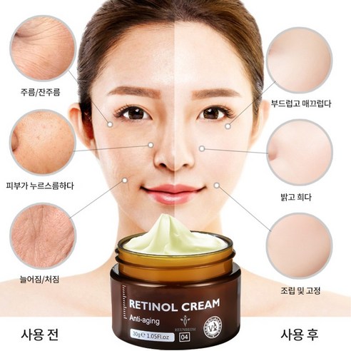[최저가 추천]일본 기미크림 빛나는 피부를 위한 기적의 콤보: 기미 잡티 크림과 레티놀 주름 크림 [TOP 5]