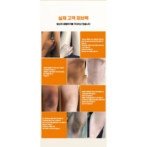 멜라토닌 크림을 통한 어두운 색소 침착 개선