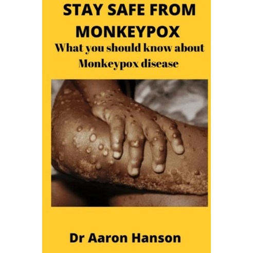 (영문도서) Stay Safe from Monkeypox: What You Should Know About Monkeypox Disease Paperback, Independently Published, English, 9798844026911
