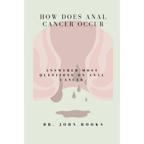(영문도서) How Does Anal Cancer Occur: Answered Most Questions on Anal Cancer Paperback, Independently Published, English, 9798867532567