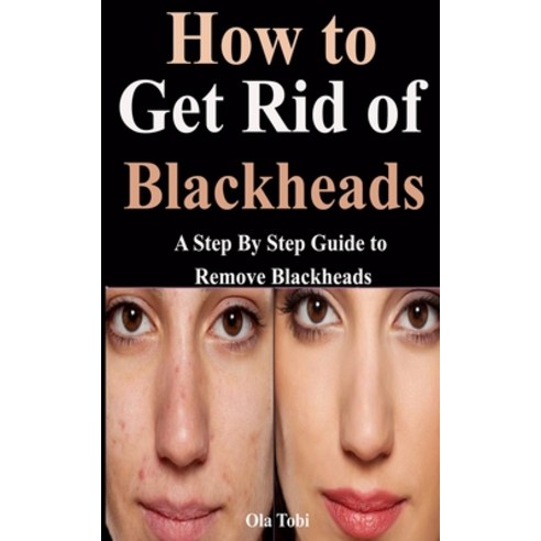 How to Get Rid of Blackheads: A Step By Step Guide to Remove Blackheads Paperback, Independently Published