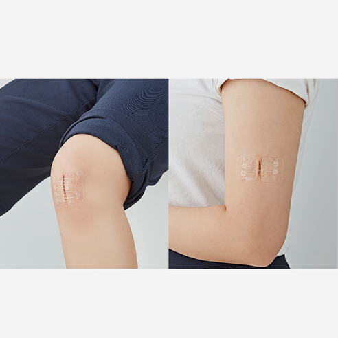 갑작스런 상처, 꿰매는 고통 없이! 서지너스 응급 상처봉합 풀밴드 봉합키트 솔직 후기 풀밴드봉합키트