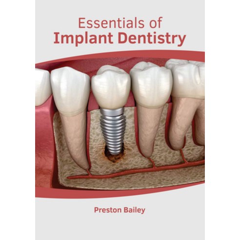 (영문도서) Essentials of Implant Dentistry Hardcover, American Medical Publishers, English, 9781639270538