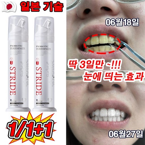 딱 3일만! 일본 1/1+1 누렁이 미백 치약 – 구취 케어, 착색 제거, 충치 예방, 100g 
구강/면도