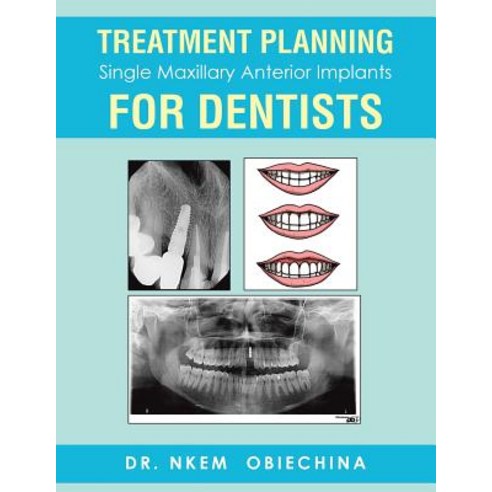 (영문도서) Treatment Planning Single Maxillary Anterior Implants for Dentists Paperback, Authorhouse, English, 9781546242789