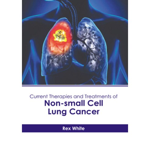(영문도서) Current Therapies and Treatments of Non-Small Cell Lung Cancer Hardcover, American Medical Publishers, English, 9798887405704