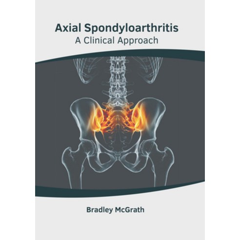 (영문도서) Axial Spondyloarthritis: A Clinical Approach Hardcover, Foster Academics, English, 9781646461448