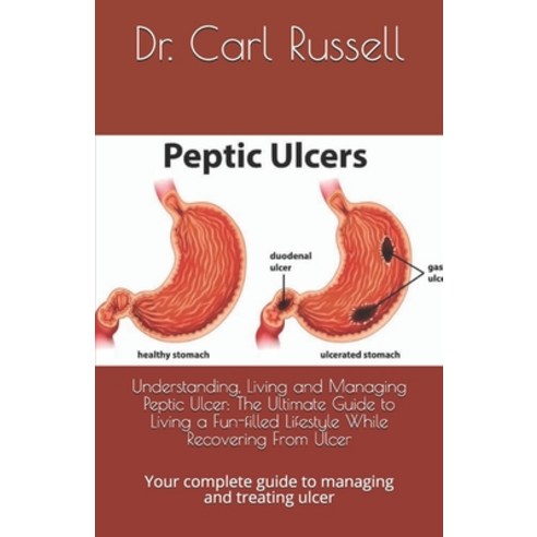 Understanding Living and Managing Peptic Ulcer: The Ultimate Guide to Living a Fun-filled Lifestyle... Paperback, Independently Published