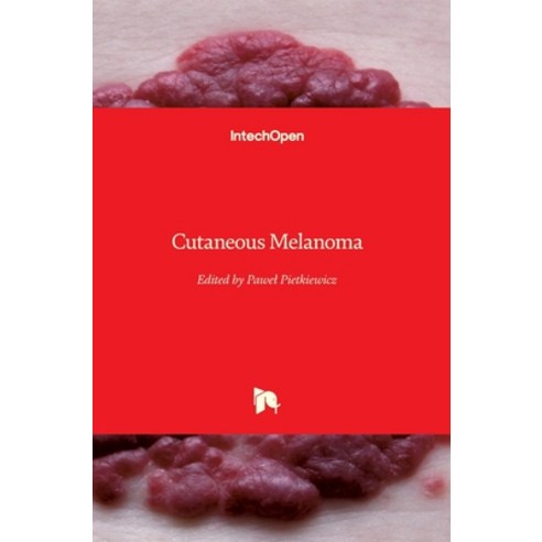 (영문도서) Cutaneous Melanoma Hardcover, Intechopen, English, 9781789841398