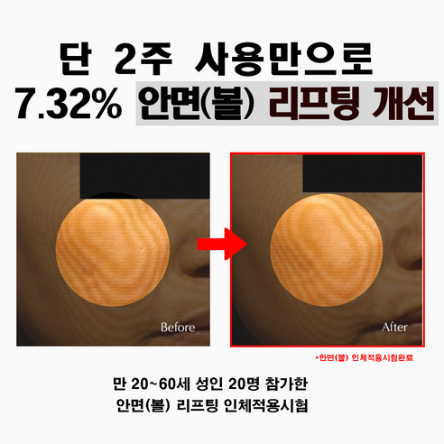 시간의 흔적을 지우고 탄력 있는 피부를 되찾다