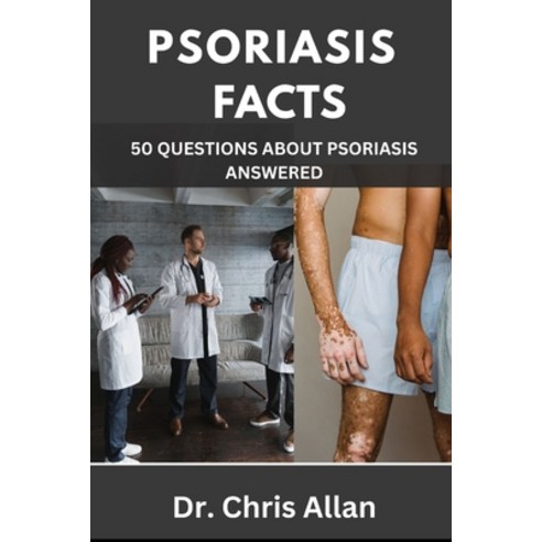(영문도서) Psoriasis Facts: 50 Questions about Psoriasis Answered. Paperback, Independently Published, English, 9798373711036