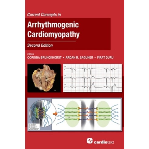 (영문도서) Current Concepts in Arrhythmogenic Cardiomyopathy Second Edition Hardcover, Cardiotext Inc, English, 9781942909507