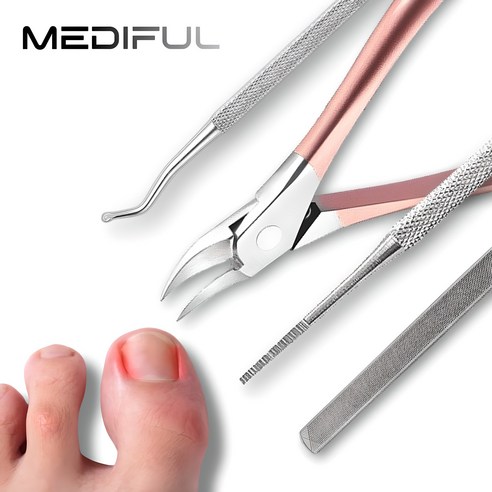 메디플 파고드는 발톱 셀프 홈케어 도구 고급형: 고통 없는 아름다움을 위한 투자 발톱니퍼