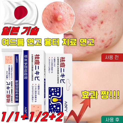 [국내배송] 일본 여드름 흉터 치료 연고 – 청소년 및 성인용 화농성 여드름 제거 리페어 크림, 30ml 2개セット