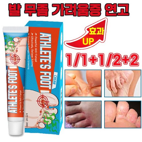 [국내배송] 발 무좀 연고 발냄새 제거 연고 발 가려움 발가락 진균 치료, 4개, 20g