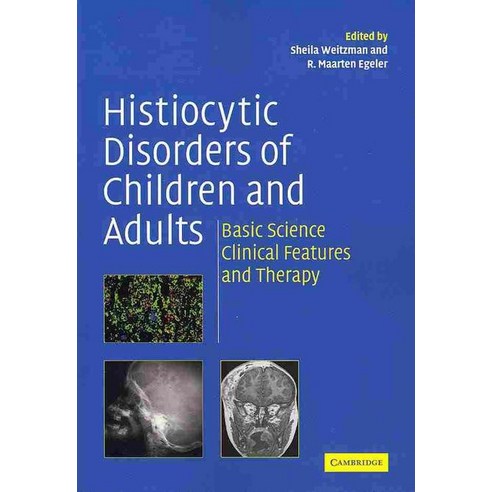 Histiocytic Disorders of Children and Adults:"Basic Science Clinical Features and Therapy", Cambridge University Press