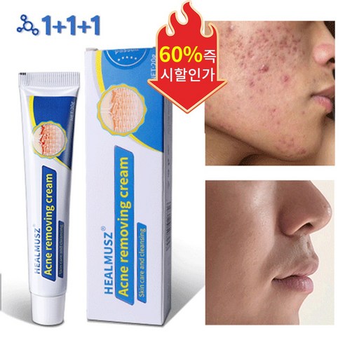 [당일배송] 여드름 연고 여드름 치료 스킨 배리어 리커버리 수부지 관리 크림, 1개, 20ml