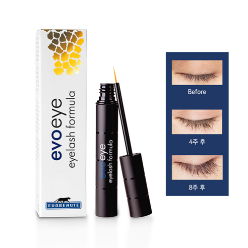 독일 에보보떼 에보아이, 속눈썹 재생으로 되찾는 자신감