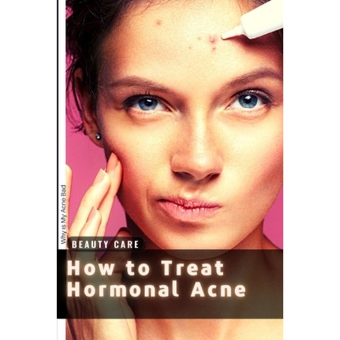 (영문도서) How t&#1086; Treat Hormonal Acne: Why &#1110;s My Acne Bad? Paperback, Independently Published, English, 9798514449644
