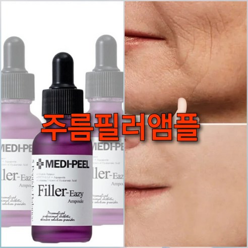 주름필러 안티에이징앰플/미간주름 입가주름, 1개 이마보톡스 효과 시기