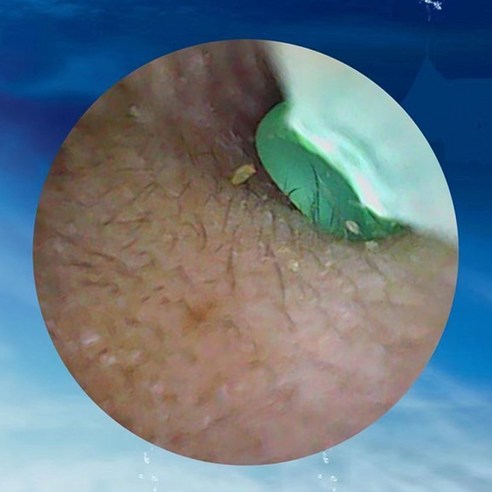 고화질 카메라와 LED 조명, 편리한 Type-C 충전으로 언제 어디서나 편리하게 귀 청결 관리를 할 수 있는 다기능 귀이개