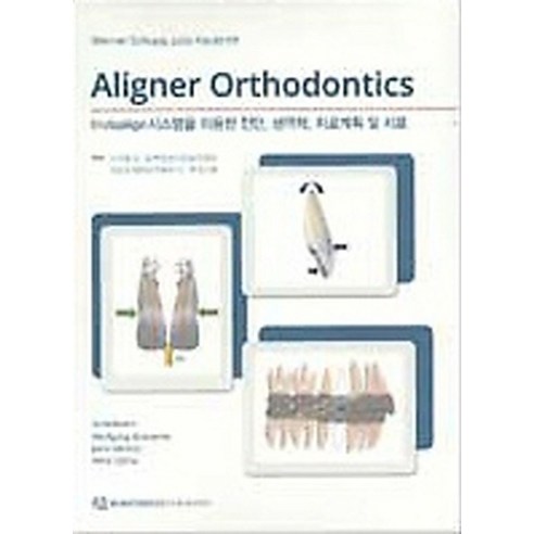 Aligner Orthodontics:Invisalign 시스템을 이용한 진단 생역학 치료계획 및 치료, 한국퀸테센스, Werner Schupp