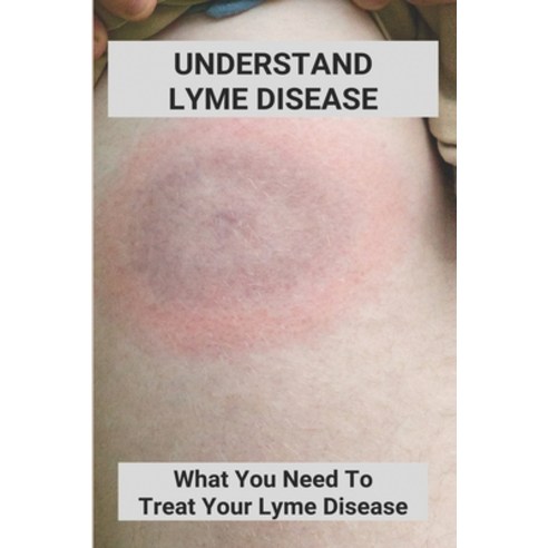 Understand Lyme Disease: What You Need To Treat Your Lyme Disease: Lyme Disease In Dogs Treatment Paperback, Independently Published, English, 9798738228582
